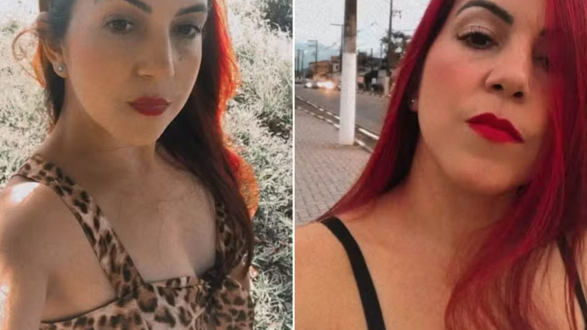 mulher morre após cirurgia plástica